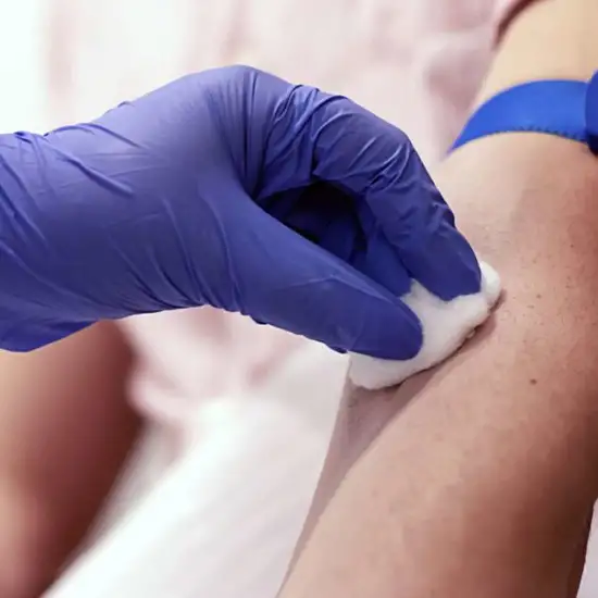 serum insulin antibody highly sensitive test